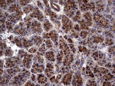 Immunohistochemistry: PDE1A Antibody (OTI7D5) [NBP2-46355]