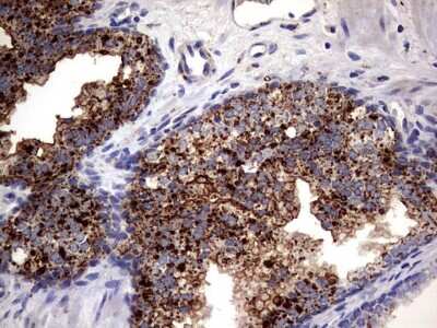 Immunohistochemistry: PDE1A Antibody (OTI7D5) [NBP2-46355]