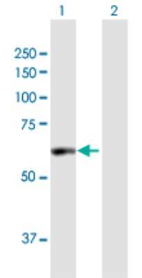 Western Blot: PDE1A Antibody [H00005136-B01P]