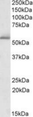 Western Blot: PDE1A Antibody [NBP1-51996]