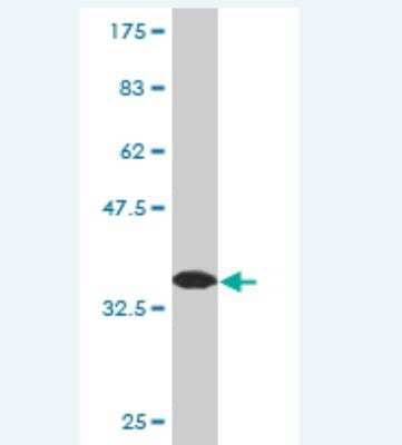 Western Blot: PDE1B Antibody (4E8) [H00005153-M05]