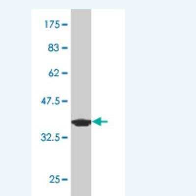 Western Blot: PDE1B Antibody (4F9) [H00005153-M02]