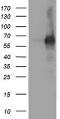 Western Blot: PDE1B Antibody (OTI6E4)Azide and BSA Free [NBP2-73278]