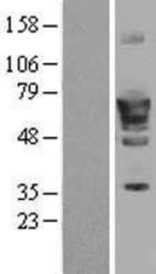 Western Blot: PDE1B Overexpression Lysate [NBL1-14215]