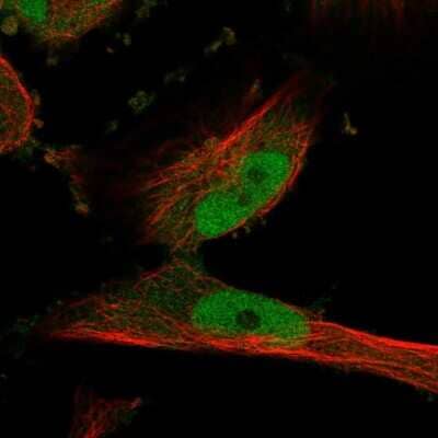 Immunocytochemistry/ Immunofluorescence: PDE1C Antibody [NBP2-38666]