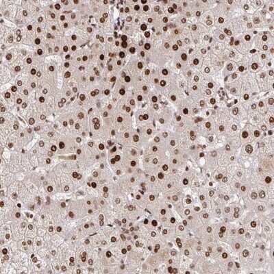 Immunohistochemistry-Paraffin: PDE1C Antibody [NBP2-38666]