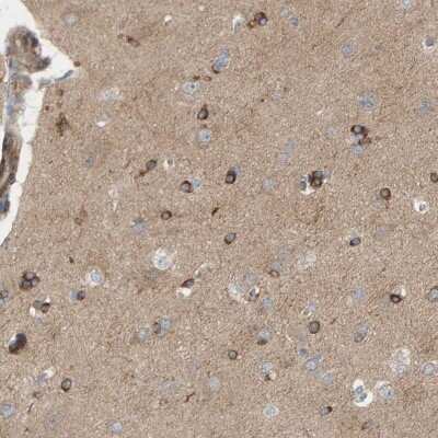 Immunohistochemistry-Paraffin: PDE1C Antibody [NBP2-48555]