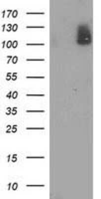 Western Blot: PDE2A Antibody (OTI3A4) [NBP2-03598]