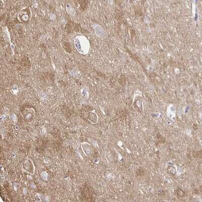 Immunohistochemistry: PDE2A Antibody [NBP2-48608]