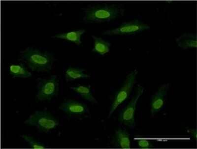 Immunocytochemistry/ Immunofluorescence: PDE3A Antibody (2D7) [H00005139-M03]