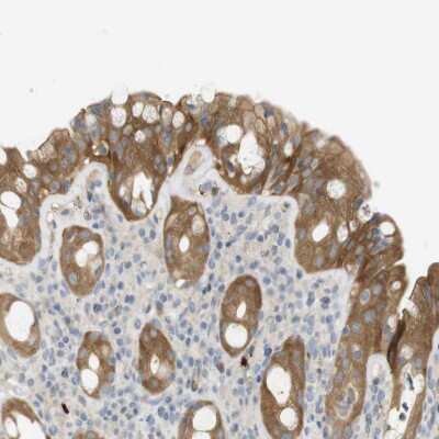 Immunohistochemistry-Paraffin: PDE3A Antibody [NBP1-85645]
