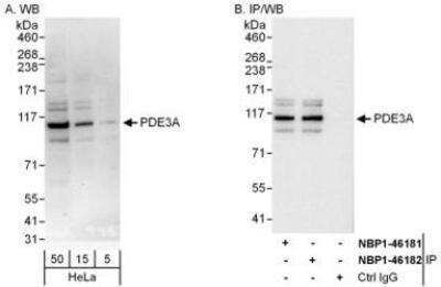 Western Blot: PDE3A Antibody [NBP1-46181]