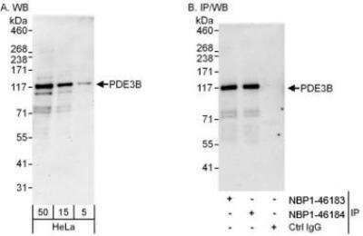 Western Blot: PDE3B Antibody [NBP1-46183]