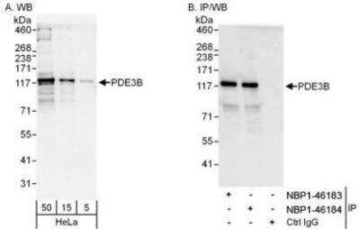 Western Blot: PDE3B Antibody [NBP1-46184]