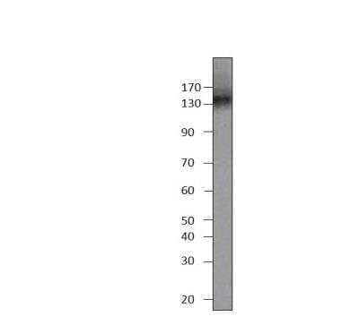 Western Blot: PDE3B Antibody [NBP3-12440]