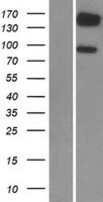 Western Blot: PDE3B Overexpression Lysate [NBP2-08990]