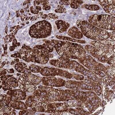 Immunohistochemistry: Phosphodiesterase 4A/PDE4A Antibody [NBP2-33388]