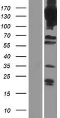 Western Blot: Phosphodiesterase 4A/PDE4A Overexpression Lysate [NBP2-09382]