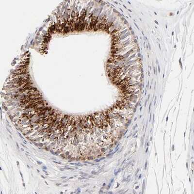 Immunohistochemistry-Paraffin: PDE4B Antibody [NBP1-84057]