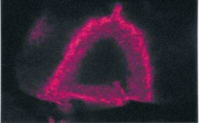 Immunohistochemistry-Paraffin: PDE4B Antibody [NBP3-12243]