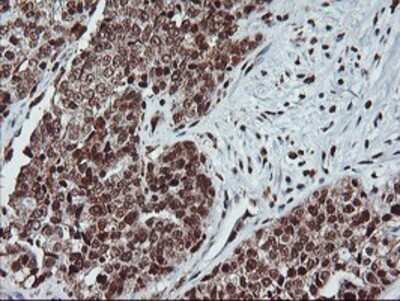 Immunohistochemistry: PDE4B Antibody (OTI1D12) - Azide and BSA Free [NBP2-73292]