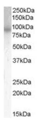 Western Blot: PDE4B Antibody [NB100-2562]