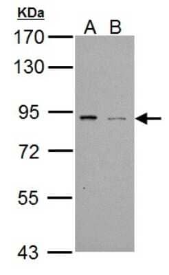 Western Blot: PDE4B Antibody [NBP1-33637]