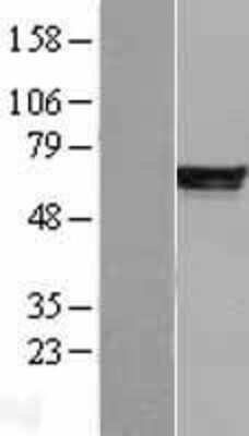 Western Blot: PDE4B Overexpression Lysate [NBL1-14219]