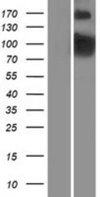 Western Blot: PDE4B Overexpression Lysate [NBP2-08546]