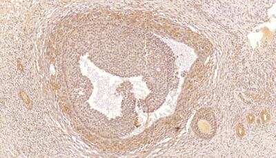 Immunohistochemistry: PDE4C Antibody [NB300-681]