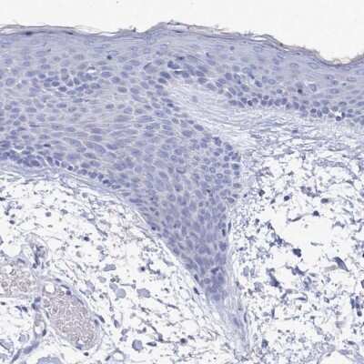 Immunohistochemistry-Paraffin: PDE4C Antibody [NBP2-33543]