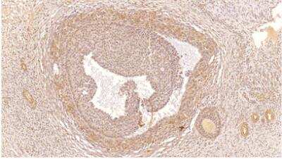 Immunohistochemistry-Paraffin: PDE4C Antibody [NBP3-12244]