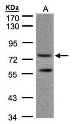 Western Blot: PDE4C Antibody [NBP1-32341]