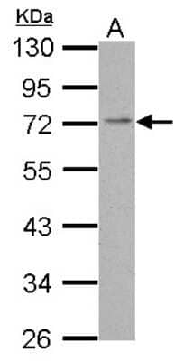 Western Blot: PDE4C Antibody [NBP2-19746]