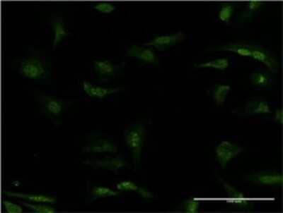 Immunocytochemistry/ Immunofluorescence: PDE5A Antibody (1F11) [H00008654-M02]
