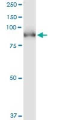 Western Blot: PDE5A Antibody (1F11) [H00008654-M02]