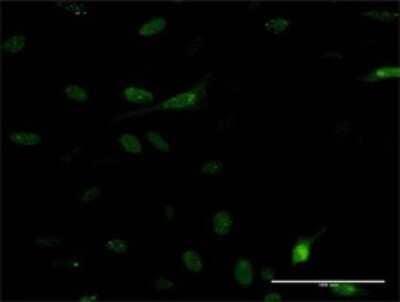 Immunocytochemistry/ Immunofluorescence: PDE5A Antibody (9H5) [H00008654-M01]