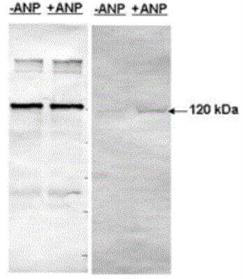 Western Blot: PDE5A Antibody [NB300-655]