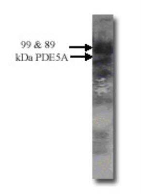 Western Blot: PDE5A Antibody [NB300-655]