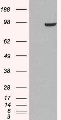 Western Blot: PDE5A Antibody [NB300-957]