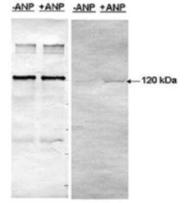 Western Blot: PDE5A Antibody [NBP3-12207]