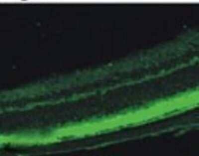 Immunocytochemistry/ Immunofluorescence: PDE6 beta Antibody [NB120-5663]