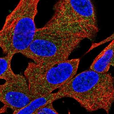 Immunocytochemistry/ Immunofluorescence: PDE6 beta Antibody [NBP2-56205]