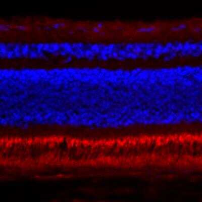 Immunohistochemistry-Frozen: PDE6 beta Antibody [NB120-5663]