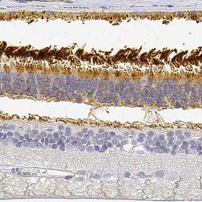 Immunohistochemistry-Paraffin: PDE6 beta Antibody [NBP2-56205]