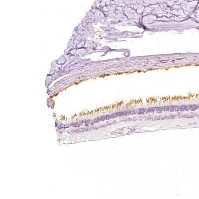 Immunohistochemistry-Paraffin: PDE6 beta Antibody [NBP2-58654]