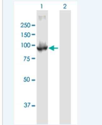 Western Blot: PDE6 beta Antibody [H00005158-B01P-50ug]