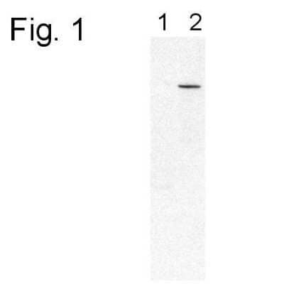 Western Blot: PDE6 beta Antibody [NB120-5663]