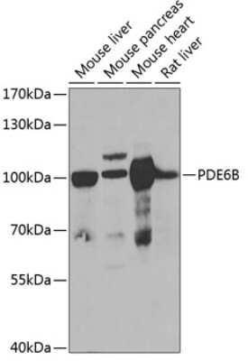 Western Blot: PDE6 beta AntibodyBSA Free [NBP2-95225]