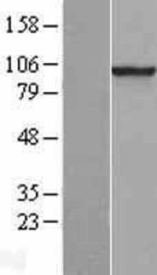 Western Blot: PDE6 beta Overexpression Lysate [NBL1-14227]